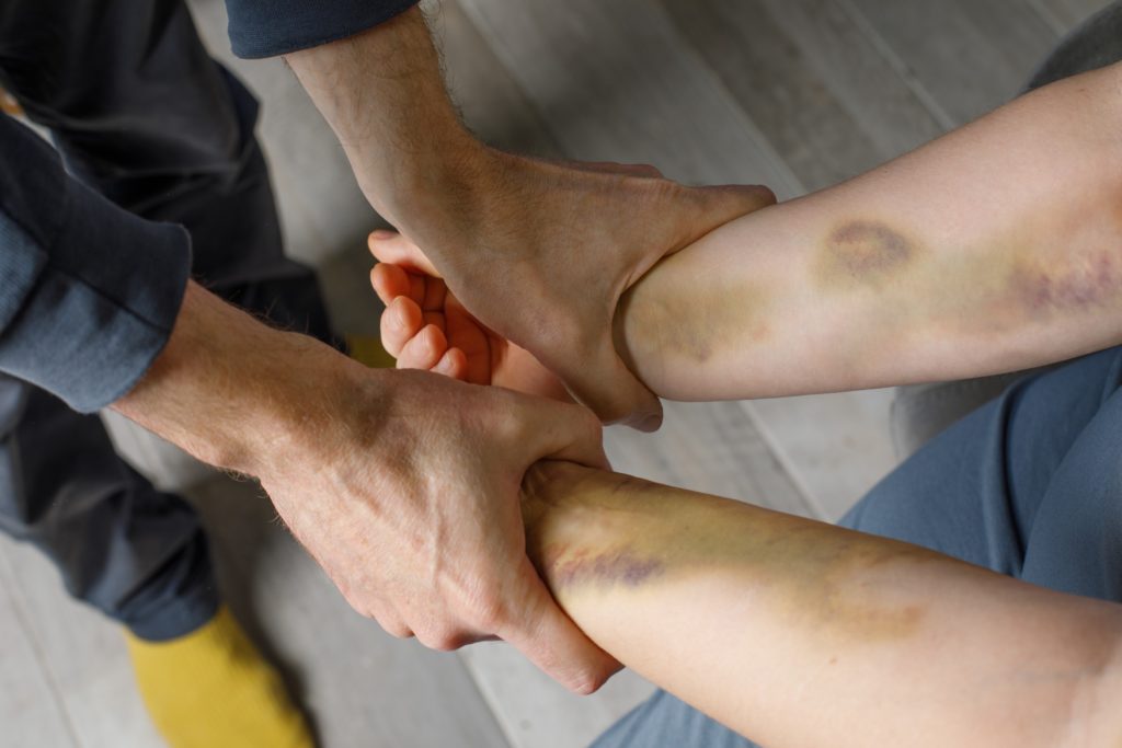 Enabling Child Abuse by Injury