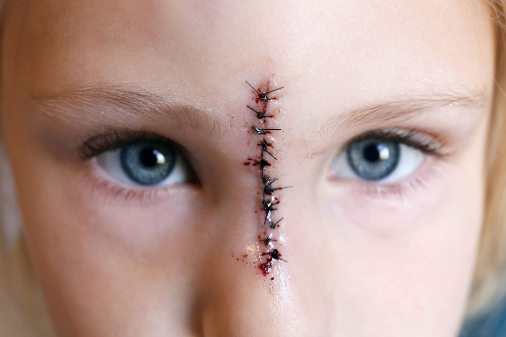 Child Abuse Charges