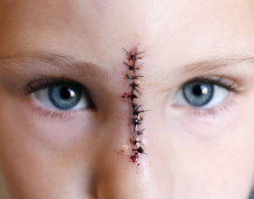 Child Abuse Charges