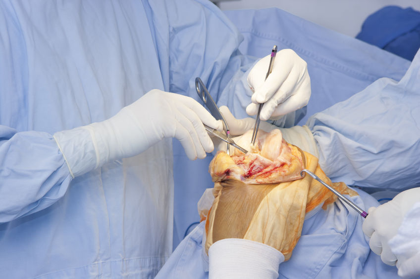 Amputations and Workers' Comp